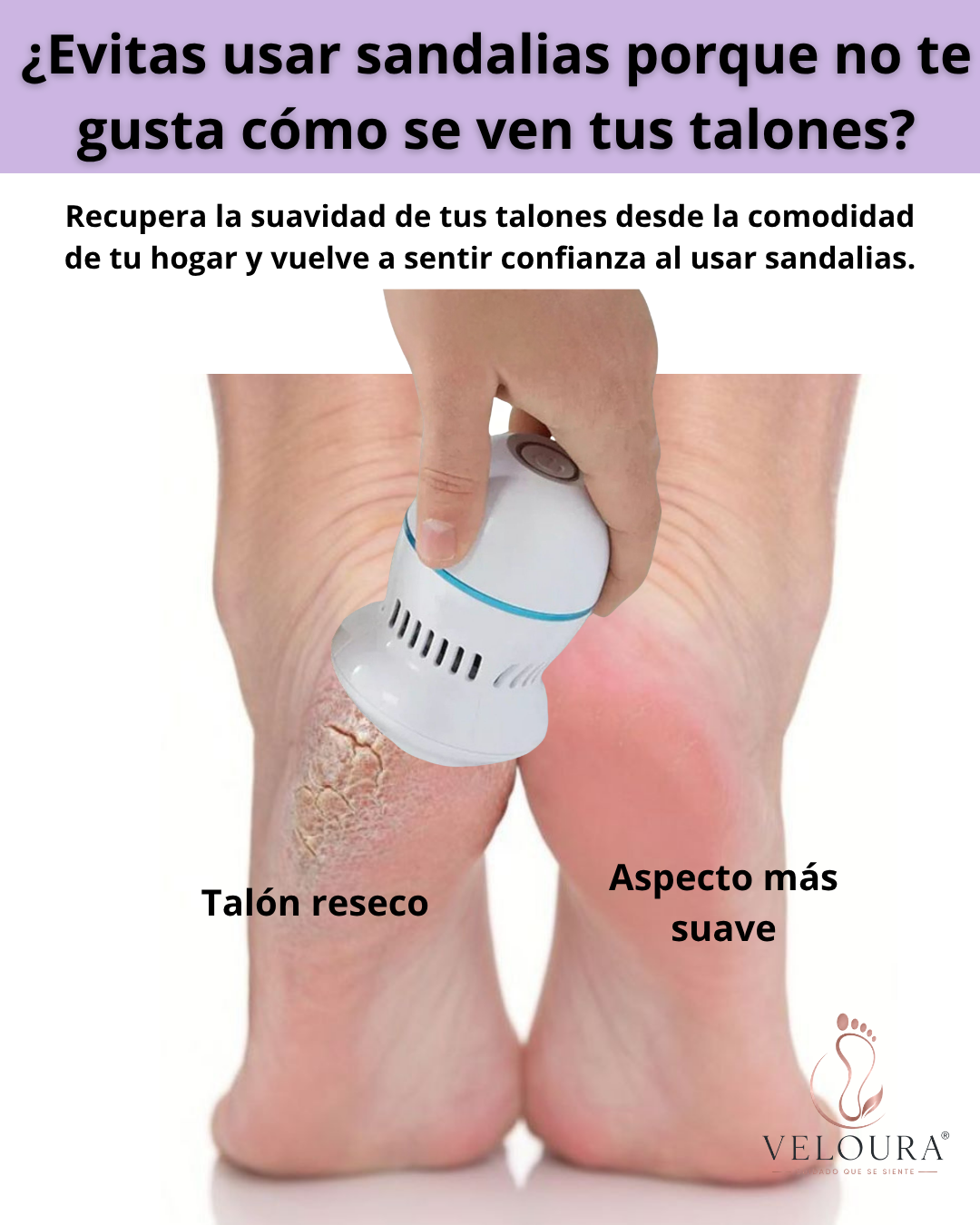 Removedor eléctrico de callos.