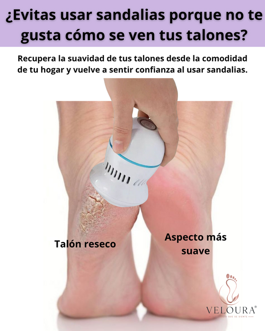 Removedor eléctrico de callos.